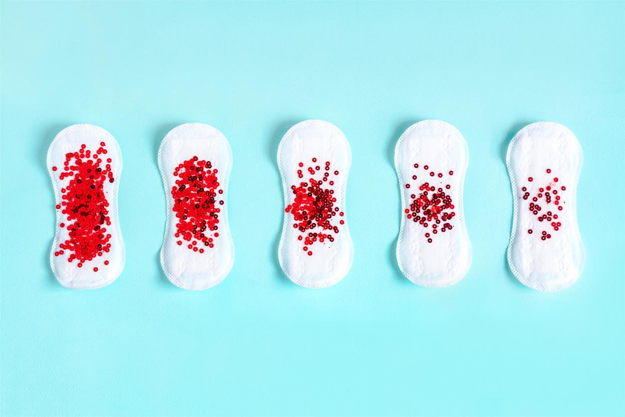 Menstruar duas vezes no mês: o que pode ser? - Garça Online - Seu