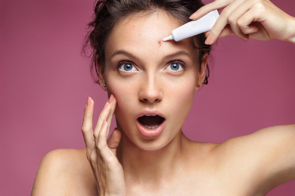 Saiba como evitar a acne no verão